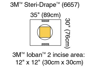 3m Steri-drape Cesarean-section Sheets & Pouches 6657